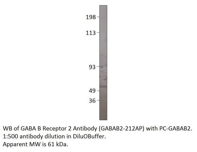 GABA B Receptor 2 Antibody in Western Blot (WB)