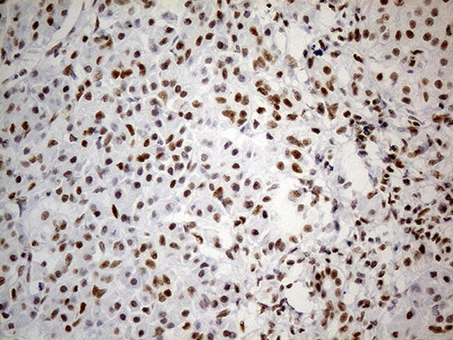 GABPB1 Antibody in Immunohistochemistry (Paraffin) (IHC (P))