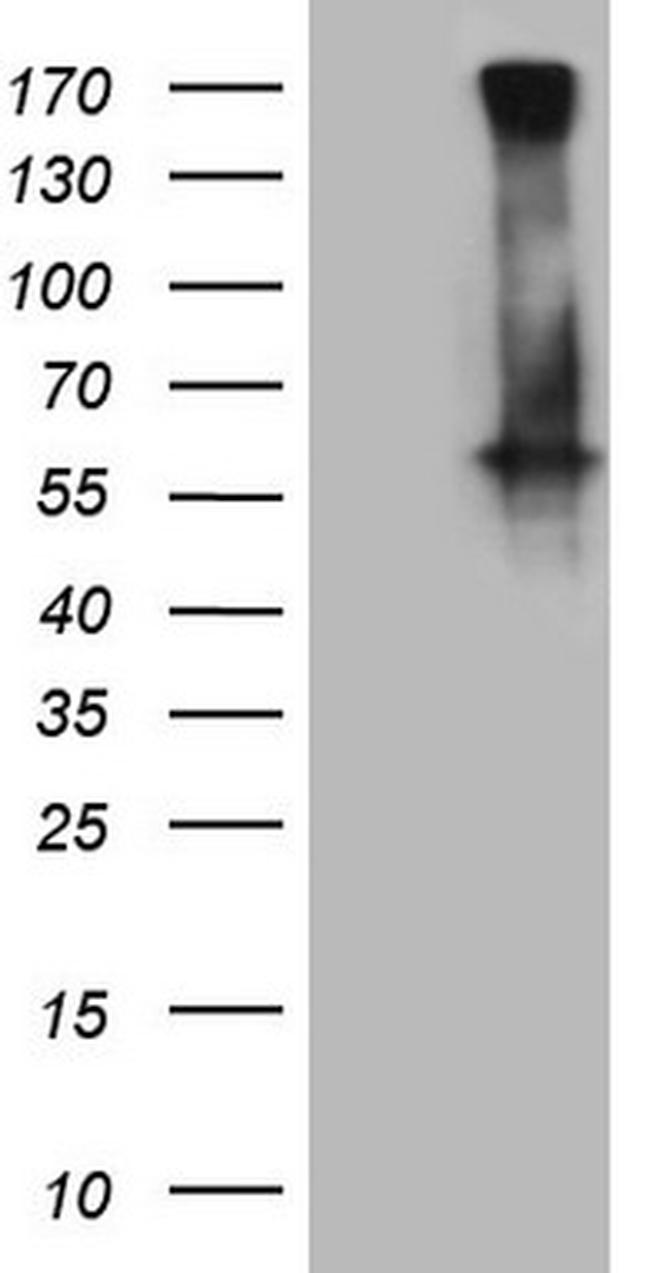 GABRA5 Antibody in Western Blot (WB)