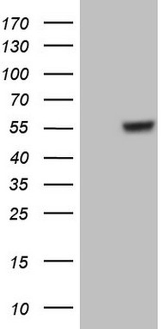 GABRA5 Antibody in Western Blot (WB)