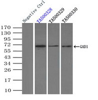 GAD1 Antibody in Immunoprecipitation (IP)