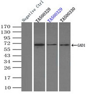 GAD1 Antibody in Immunoprecipitation (IP)