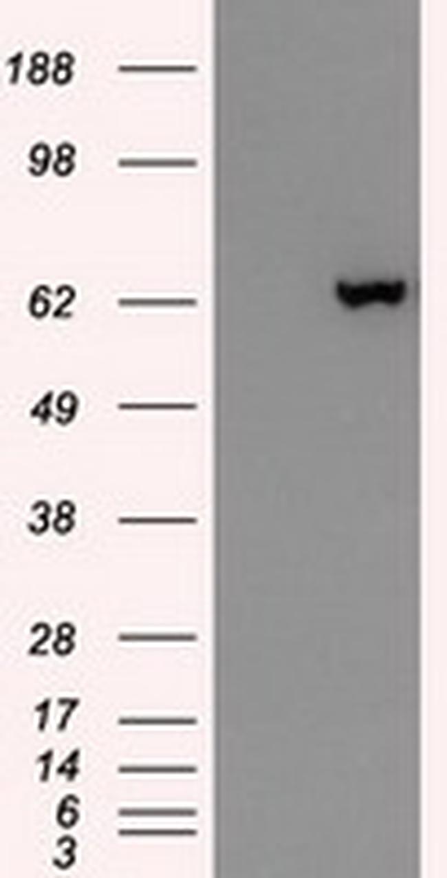 GAD1 Antibody in Western Blot (WB)