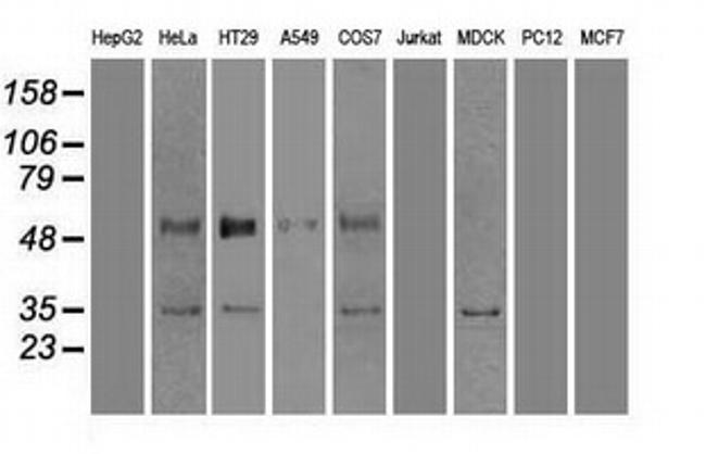 GAD1 Antibody in Western Blot (WB)