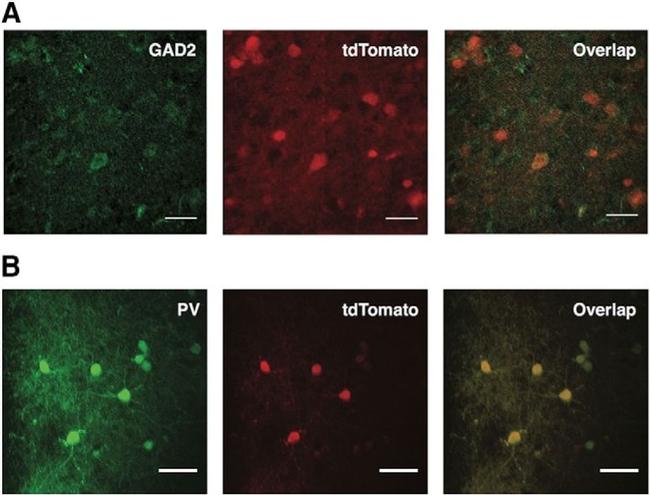 GAD65 Antibody in Immunohistochemistry (IHC)