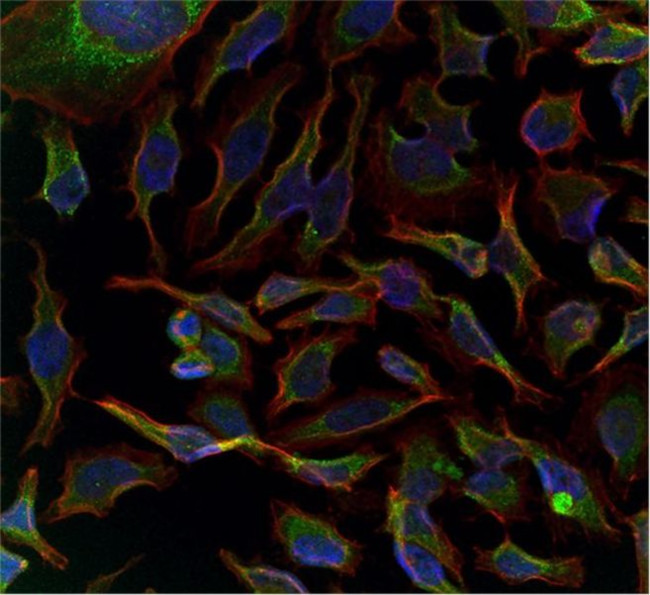 GADD34 Antibody in Immunocytochemistry (ICC/IF)