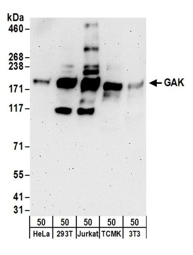 GAK Antibody in Western Blot (WB)