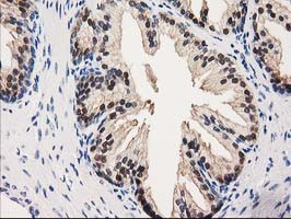 GALE Antibody in Immunohistochemistry (Paraffin) (IHC (P))