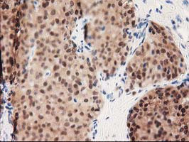 GALE Antibody in Immunohistochemistry (Paraffin) (IHC (P))