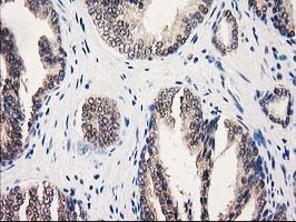 GALE Antibody in Immunohistochemistry (Paraffin) (IHC (P))