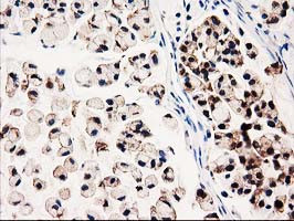 GALE Antibody in Immunohistochemistry (Paraffin) (IHC (P))