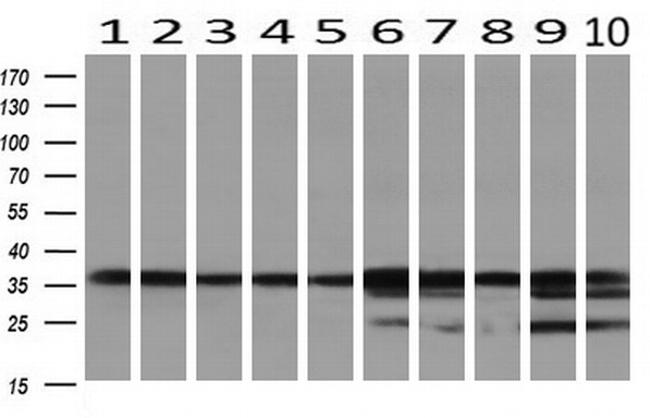 GALE Antibody in Western Blot (WB)