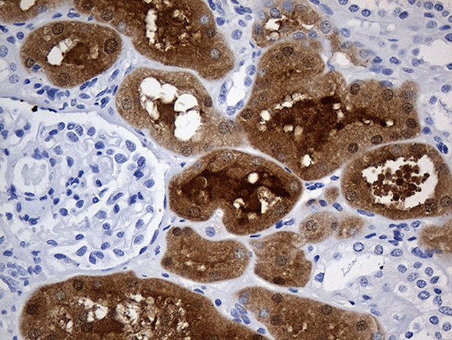 GALM Antibody in Immunohistochemistry (Paraffin) (IHC (P))