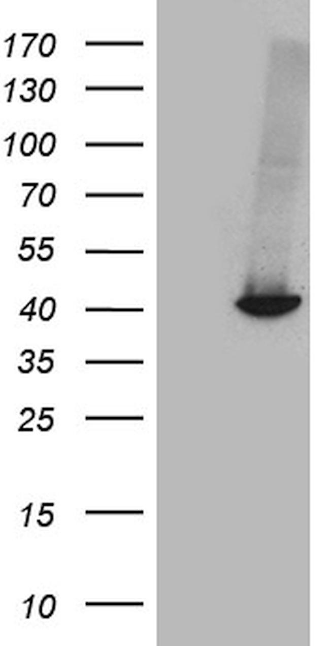 GALM Antibody in Western Blot (WB)