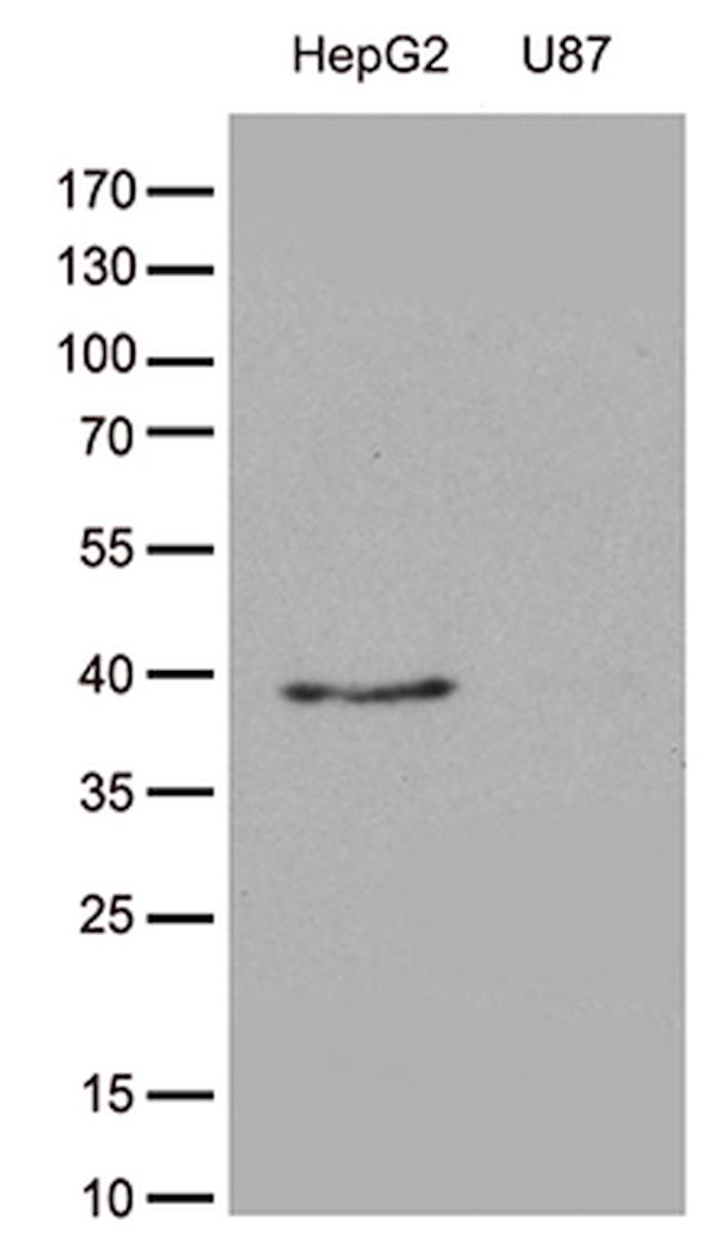 GALM Antibody in Western Blot (WB)