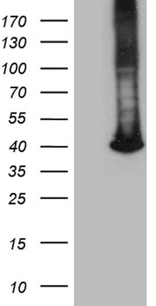 GALM Antibody in Western Blot (WB)