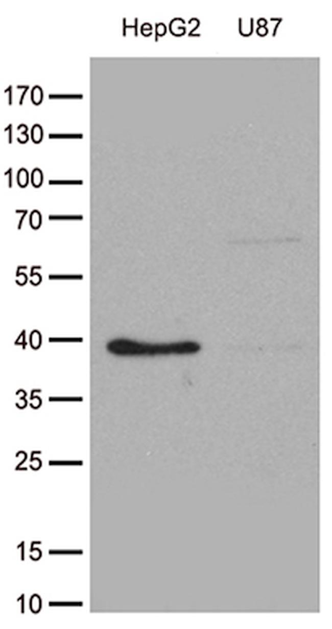 GALM Antibody in Western Blot (WB)