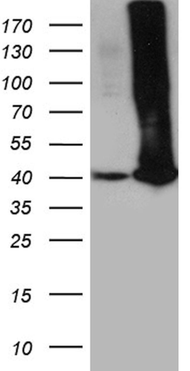 GALM Antibody in Western Blot (WB)