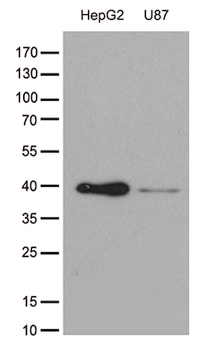 GALM Antibody in Western Blot (WB)