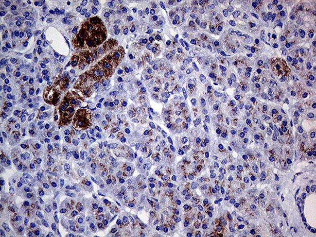 GALNT10 Antibody in Immunohistochemistry (Paraffin) (IHC (P))