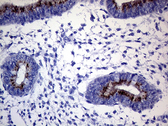 GALNT10 Antibody in Immunohistochemistry (Paraffin) (IHC (P))