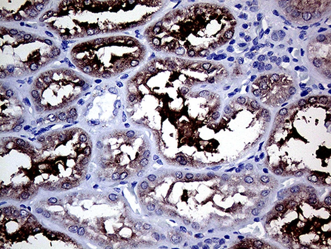 GALNT10 Antibody in Immunohistochemistry (Paraffin) (IHC (P))