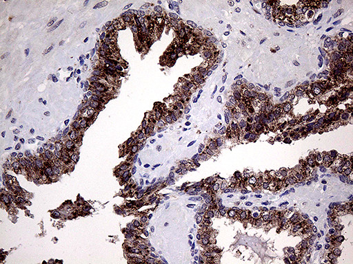 GALNT10 Antibody in Immunohistochemistry (Paraffin) (IHC (P))