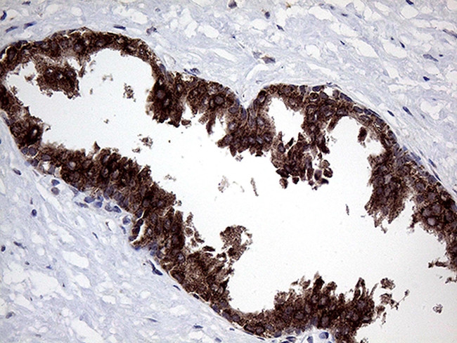 GALNT10 Antibody in Immunohistochemistry (Paraffin) (IHC (P))