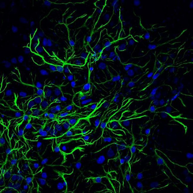 Mouse IgG (H+L) Highly Cross-Adsorbed Secondary Antibody in Immunocytochemistry (ICC/IF)