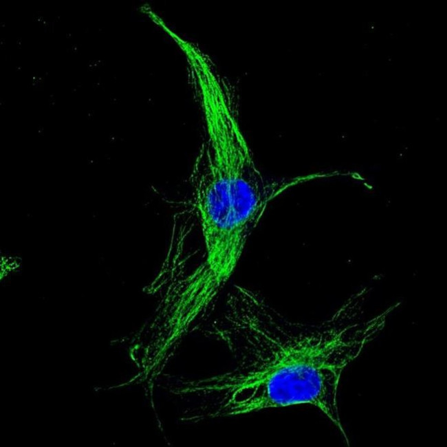 Mouse IgG (H+L) Highly Cross-Adsorbed Secondary Antibody in Immunocytochemistry (ICC/IF)