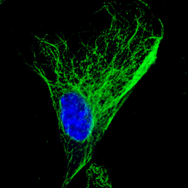 Mouse IgG (H+L) Highly Cross-Adsorbed Secondary Antibody in Immunocytochemistry (ICC/IF)