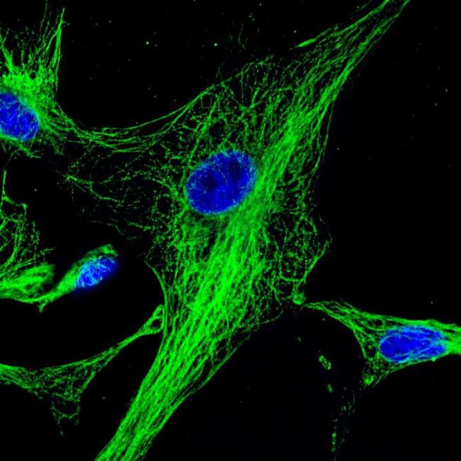 Mouse IgG (H+L) Highly Cross-Adsorbed Secondary Antibody in Immunocytochemistry (ICC/IF)