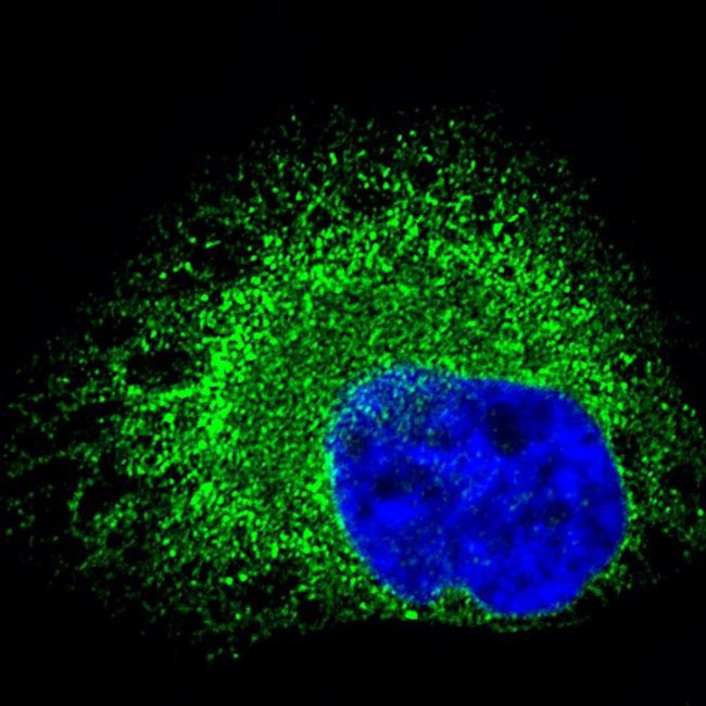 Mouse IgG (H+L) Highly Cross-Adsorbed Secondary Antibody in Immunocytochemistry (ICC/IF)