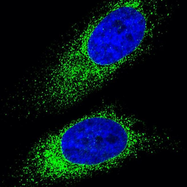 Mouse IgG (H+L) Highly Cross-Adsorbed Secondary Antibody in Immunocytochemistry (ICC/IF)