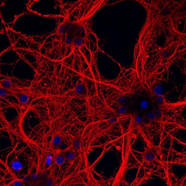 Mouse IgG (H+L) Highly Cross-Adsorbed Secondary Antibody in Immunocytochemistry (ICC/IF)