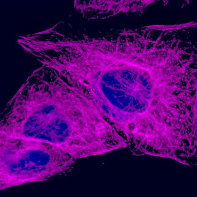 Mouse IgG (H+L) Highly Cross-Adsorbed Secondary Antibody in Immunocytochemistry (ICC/IF)