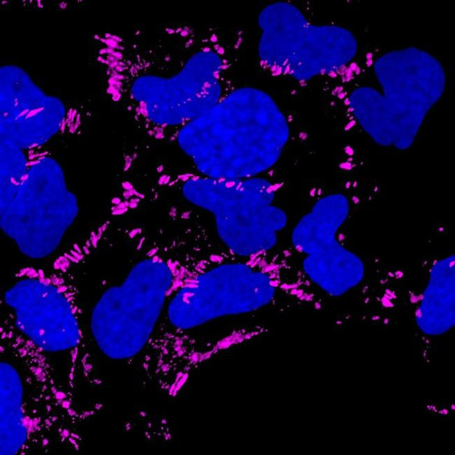 Mouse IgG (H+L) Highly Cross-Adsorbed Secondary Antibody in Immunocytochemistry (ICC/IF)