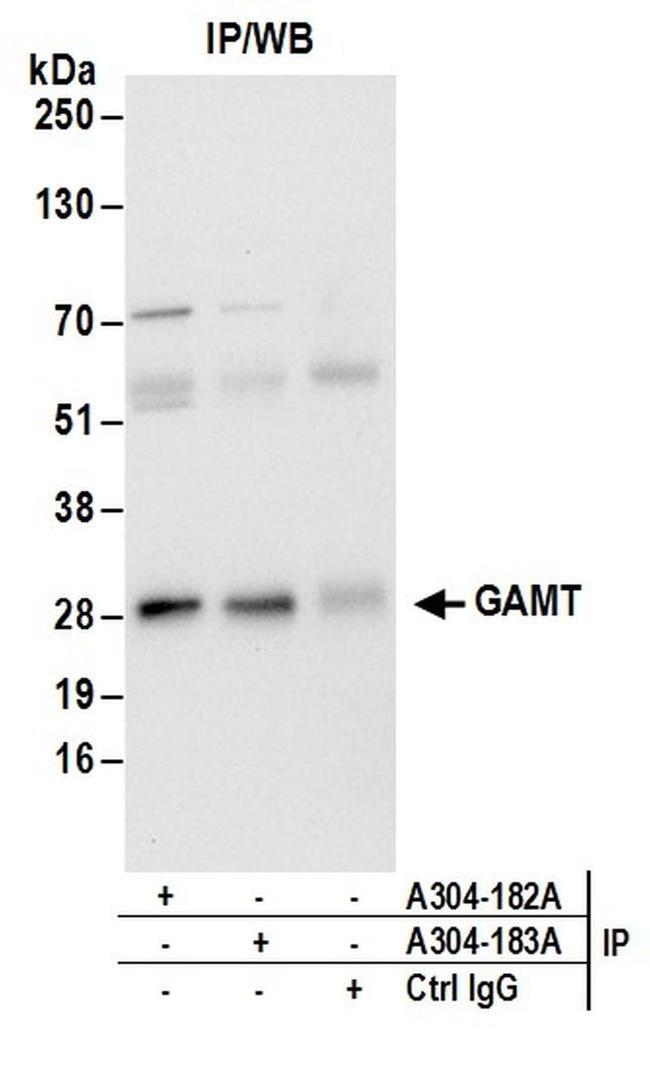 GAMT Antibody in Western Blot (WB)