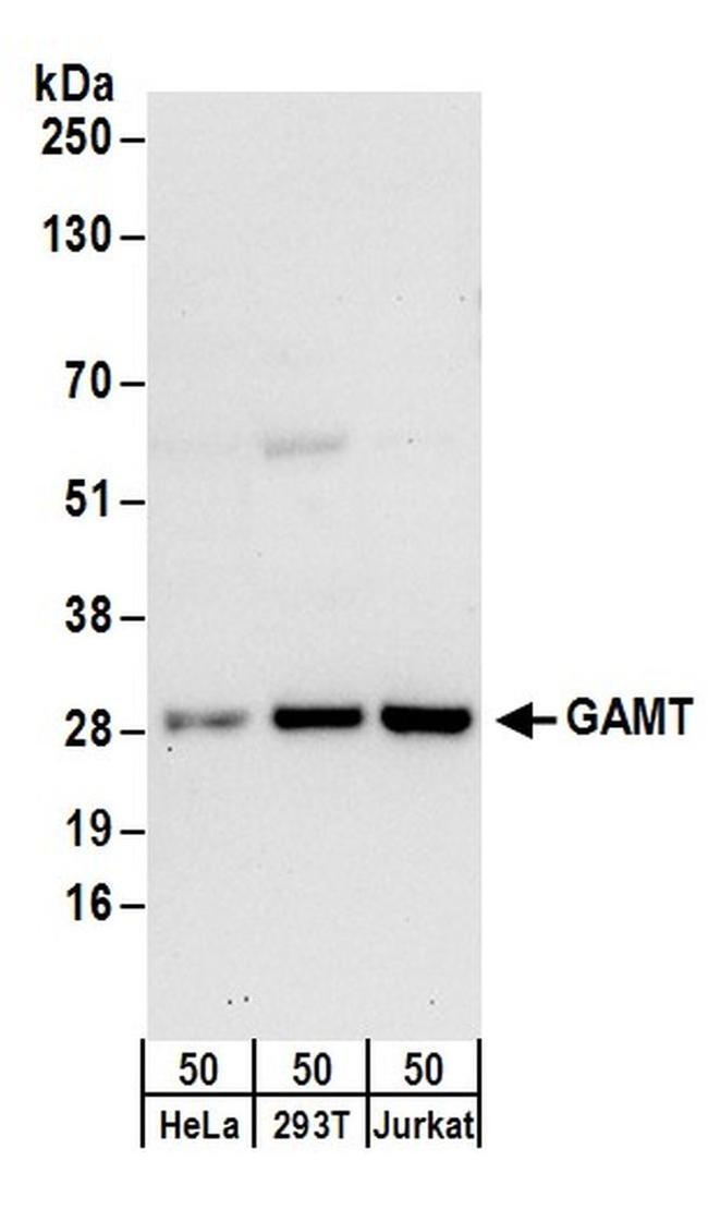 GAMT Antibody in Western Blot (WB)
