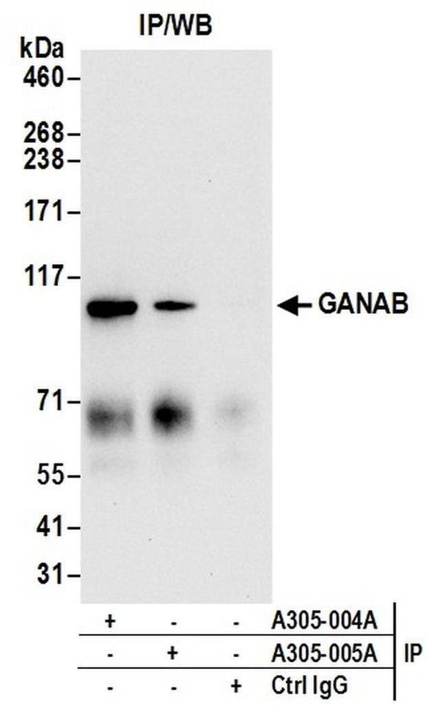 GANAB/Glucosidase II Subunit alpha Antibody in Western Blot (WB)