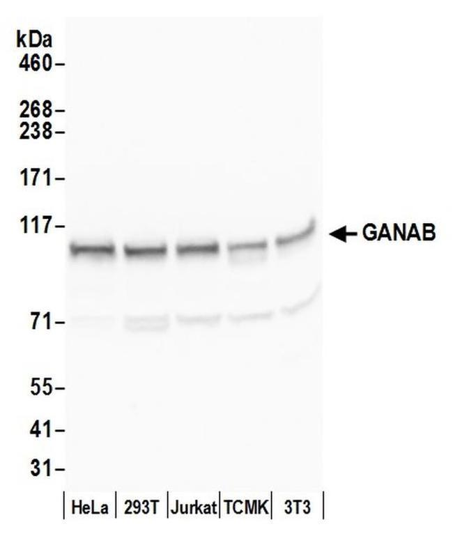 GANAB/Glucosidase II Subunit alpha Antibody in Western Blot (WB)