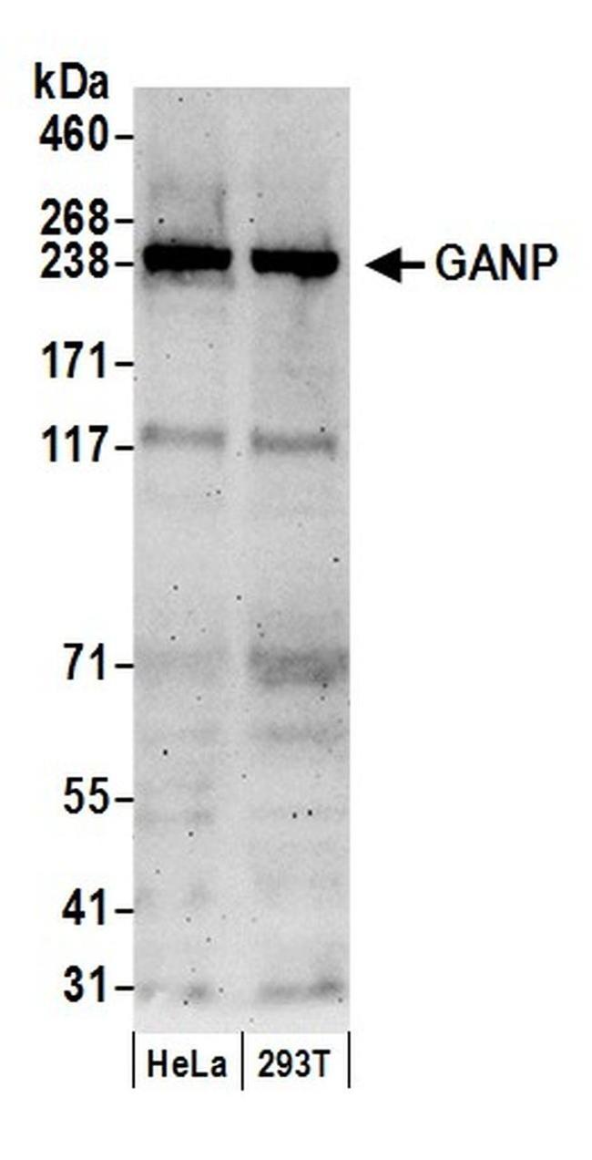 GANP Antibody in Western Blot (WB)