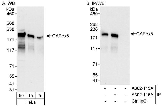 GAPex5 Antibody in Western Blot (WB)