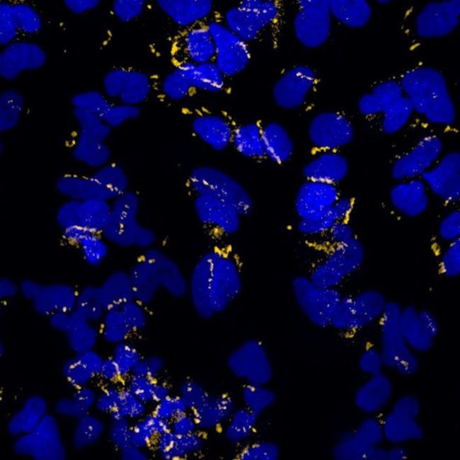 Rabbit IgG (H+L) Highly Cross-Adsorbed Secondary Antibody in Immunocytochemistry (ICC/IF)