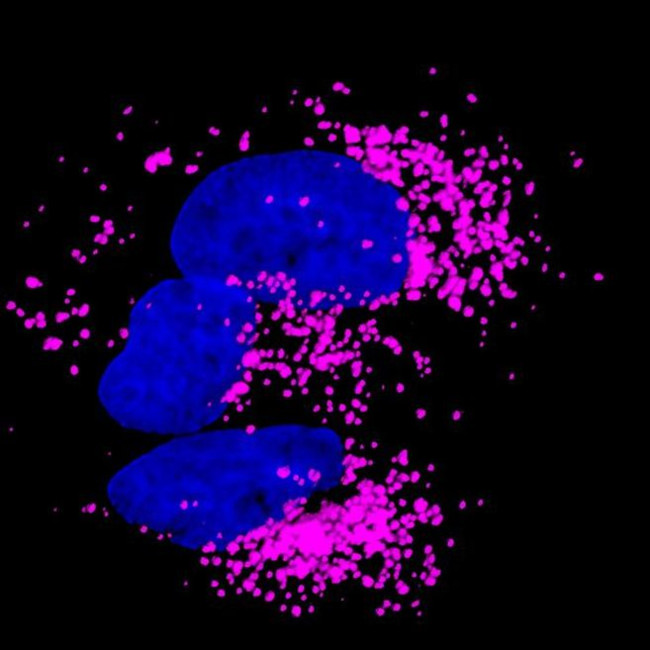 Rabbit IgG (H+L) Highly Cross-Adsorbed Secondary Antibody in Immunocytochemistry (ICC/IF)