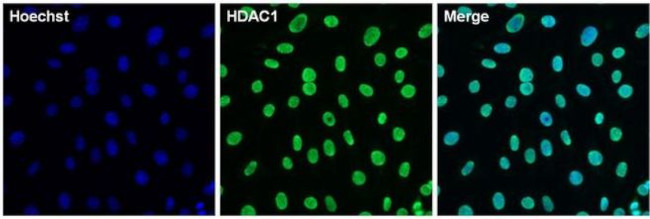 Rabbit IgG (Heavy chain) Secondary Antibody in Immunocytochemistry (ICC/IF)