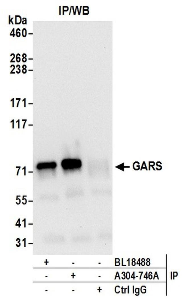 GARS Antibody in Western Blot (WB)