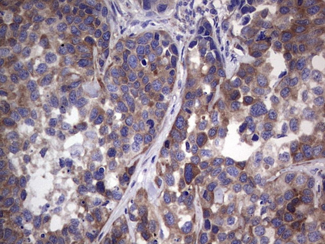 GARS Antibody in Immunohistochemistry (Paraffin) (IHC (P))