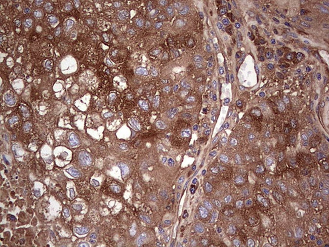 GARS Antibody in Immunohistochemistry (Paraffin) (IHC (P))