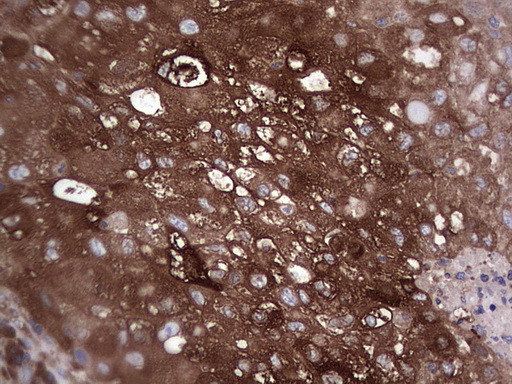 GARS Antibody in Immunohistochemistry (Paraffin) (IHC (P))